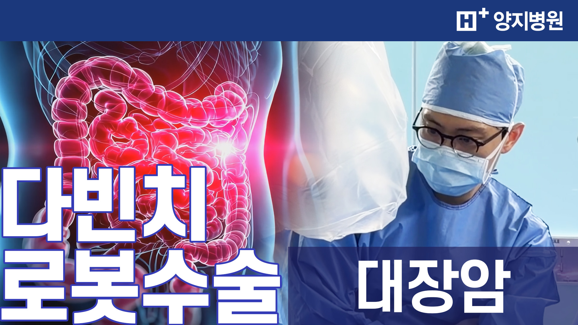  다빈치 로봇 대장암수술